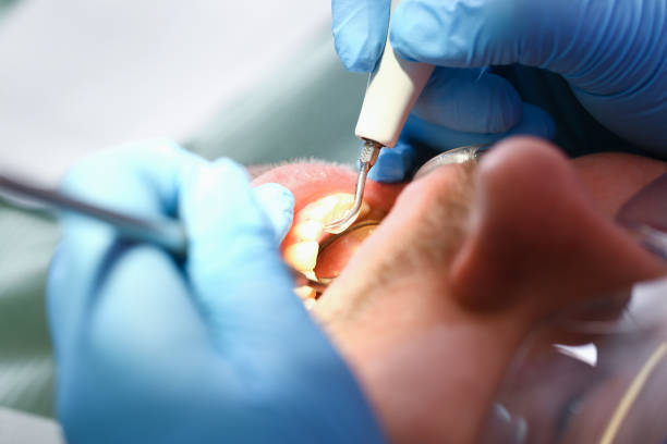 Best Emergency Denture Repair in Siloam Springs, AR